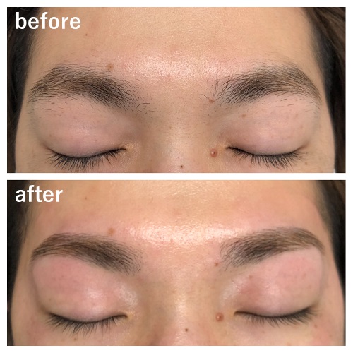 ビフォーアフター1