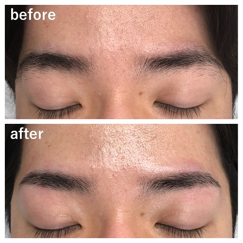 ビフォーアフター2