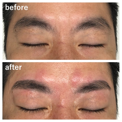 ビフォーアフター3